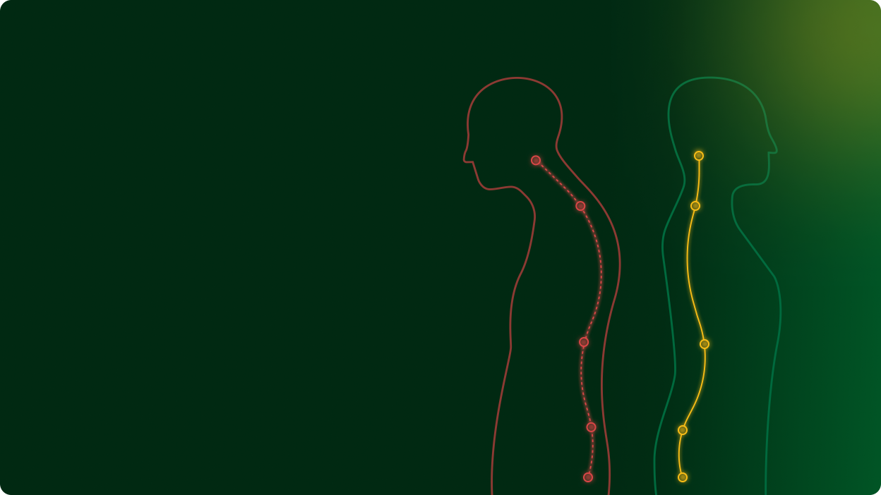 Poor posture weakens musculoskeletal health, and weak musculoskeletal health reinforces poor posture. The relationship is bi-directional.