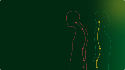 Poor posture weakens musculoskeletal health, and weak musculoskeletal health reinforces poor posture. The relationship is bi-directional.