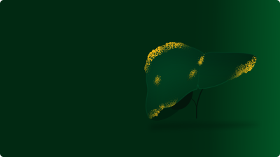 Visceral fat is a type of body fat stored deep inside the abdomen, surrounding internal organs like the liver and intestines.